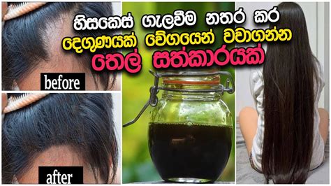 කොණ්ඩය ගැලවීම නතර කර වේගයෙන් වවාගන්න රහස් තෙල් වට්ටෝරුවක් Youtube