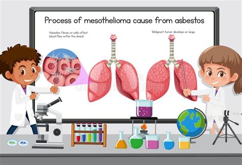 Mesothelioma Vector Illustration Labeled Lung Cancer Educational