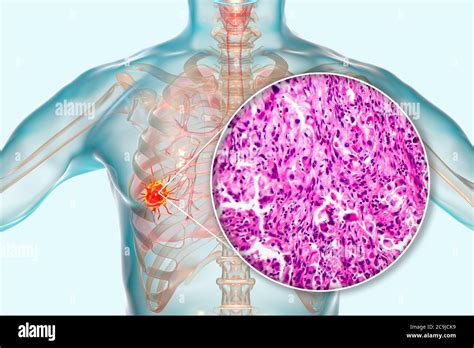 Anatomía e histología pulmonar humana Banque de photographies et d