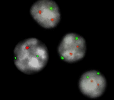 xl atmtp deletion probe metasystems probes