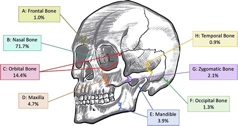 Geriatric Craniomaxillofacial Fractures Where Do They Happen And Why