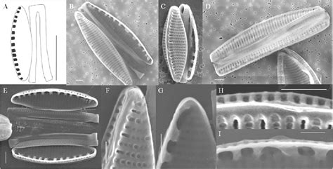 Figure From Morphology And Molecular Phylogeny Of The Marine Diatom