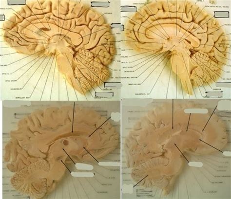 Lab Thick Sagittal Slices Diagram Quizlet