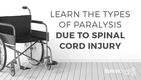 Learn the Types of Paralysis Due to Spinal Cord Injury