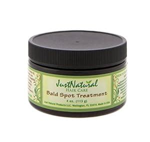 Amazon.com: Just Natural Bald Spot Treatment 4.0 oz: Beauty