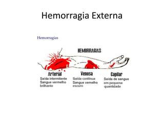 Primeiros Socorros Prs Hemorragia Ppt