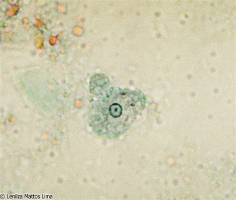 Trofozoítos De Entamoeba Histolytica E Dispar Fotografias Microscópicas E Macroscópicas