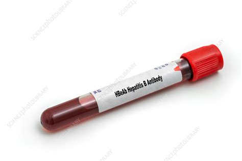 Hepatitis B antibody test, conceptual image - Stock Image - F037/0468 ...