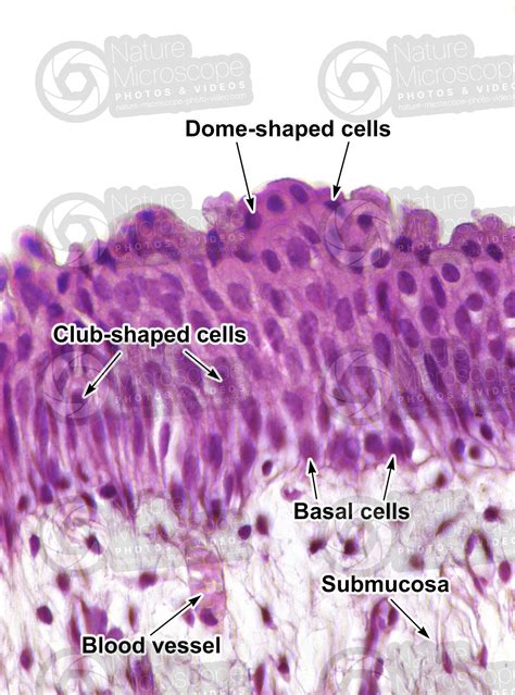 Man Ureter Transverse Section X Man Mammals Excretory