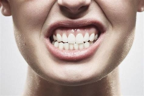 Ranger Os Dentes Saiba Todas As Consequ Ncias Desse H Bito