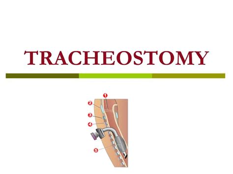 Ppt Tracheostomy Powerpoint Presentation Free Download Id 742432