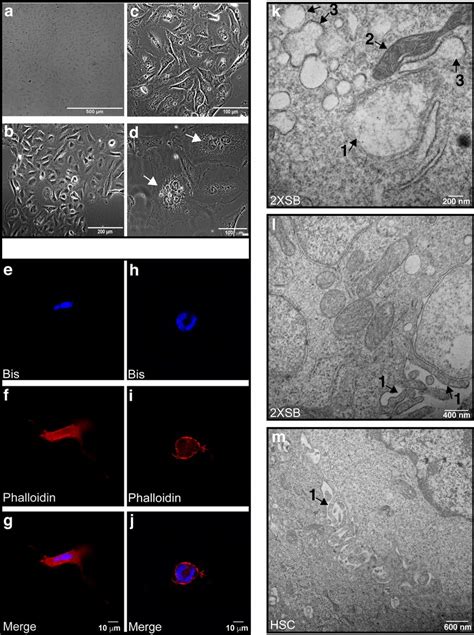 The Morphology Of The 2xsb Sporadic Mpnst Cell Line Recapitulates The