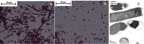 √100以上 E Coli Morphology Gram Stain 283207 Li Gram Stain Morphology And Arrangement