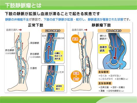 血管外科 社会医療法人一成会 木村病院