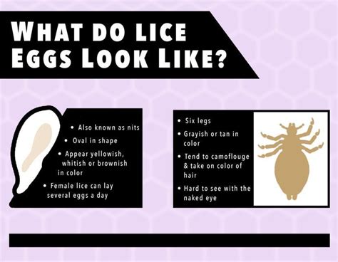 6 natural remedies to get rid of HEAD LICE EGGS – FindaTopDoc