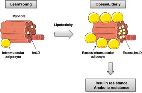 Intramyocellular Fat Storage In Metabolic Diseases