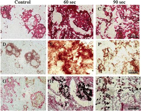 Light Enhanced Bone Regeneration In An Athymic Nude Mouse Implanted