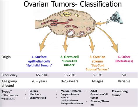 Management Of Germ Cell Tumors A Review Kauvery Hospital