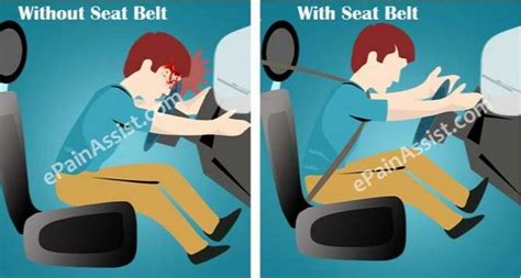 Seat belt mechanism (epainassist.com) | Download Scientific Diagram