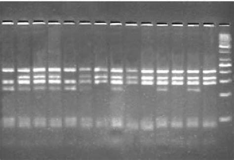 Msp1 Digestion Pattern Of 565bp Fragment Of Rbp4 Gene Download