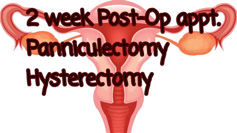 Week Post Op Appt Panniculectomy Hysterectomy Youtube