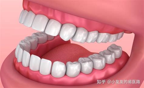 患有牙周炎，牙齿敏感怕冷怕热、牙龈萎缩怎么办？中医：日常一个方法或可解！ 知乎