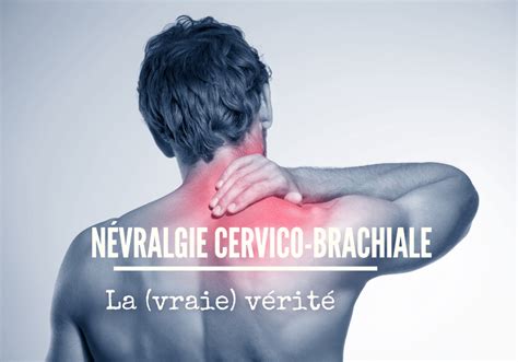 Névralgie cervico brachiale la vraie vérité Charlotte Dupré