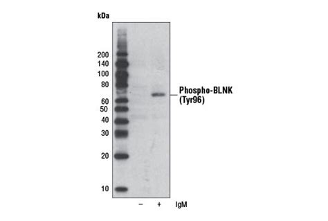 Phospho Blnk Tyr Antibody Cell Signaling Technology