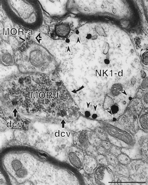 Mor Labeled Axon Terminals Sometimes Contact Nk Immunoreactive