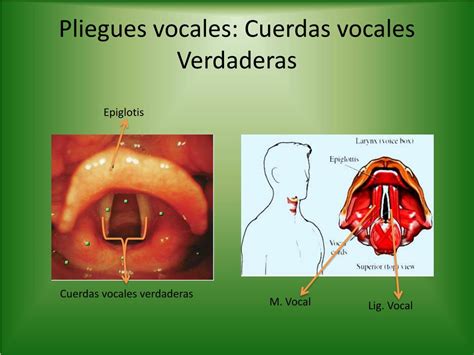 Cuerdas Vocales Y Sus Partes