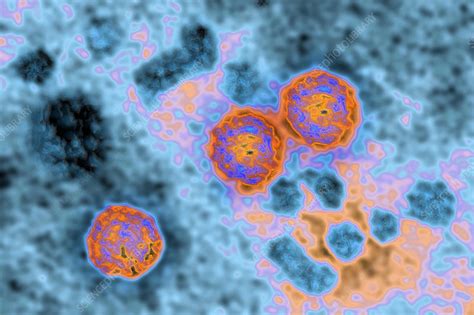 Hepatitis B Virus Stock Image C046 0211 Science Photo Library