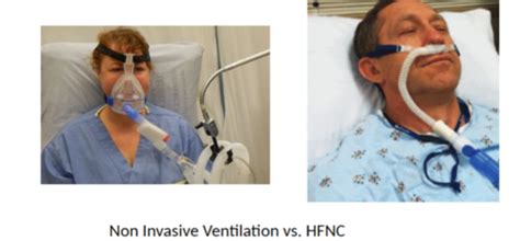 High Flow Nasal Cannula Flashcards Quizlet