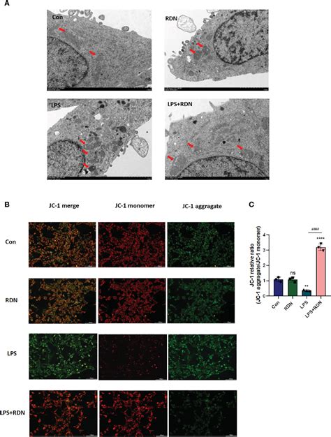 Figure 2 From Reduning Alleviates Sepsis Induced Acute Lung Injury By