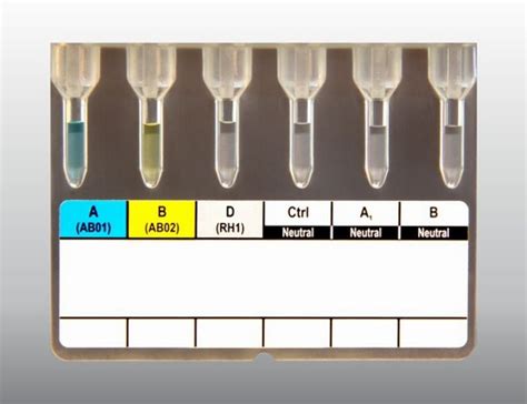 Tulip Diagnostics P Ltd Blood Banking Products