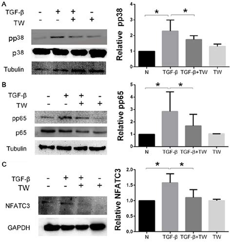 Figure 1 from Triptolide protects podocytes from TGF β induced injury