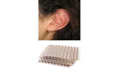 Auricular Therapy Vaccaria Ear Seeds 600 Pack Helps Quit Smokinglose