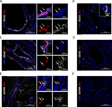 Ducts Containing Δnp63 Cells Express Gastrointestinal Stem Cell