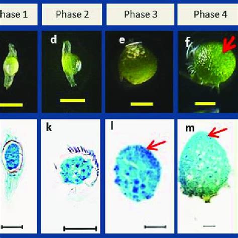 Flower And The Development Of Embryo Of Dendrobium Phalaenopsis Orchid