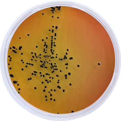 Salmonella Shigella Agar Agarindo Biological Company