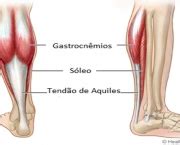 M Sculo Gastrocn Mio Medial Sa De Cultura Mix