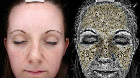 These Photos Will Convince You To Wear Sunscreen Every Second Of The