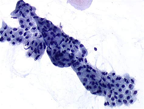 Cytopathology Of The Uterine Cervix Digital Atlas