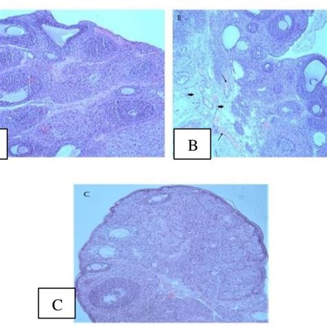 Light Microscopic Images Of Ovarian Sections Of Our Study Groups A