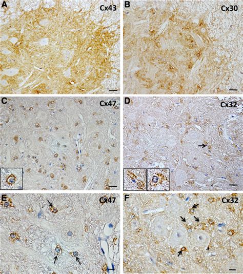 Normal Expression Patterns Of Cxs In The Anterior Horn Of The Spinal