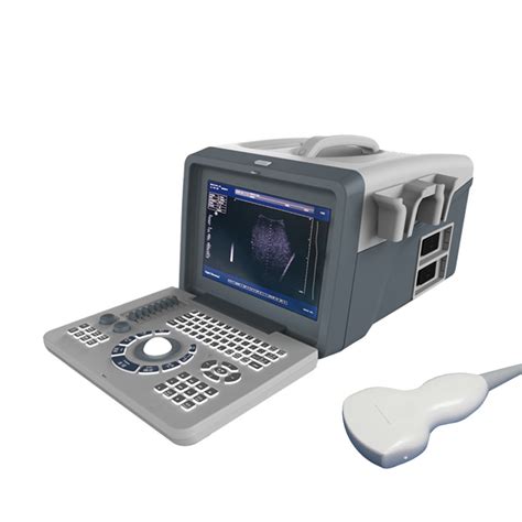 Uss Cheap Price Portable Medical Ultrasound Machine Scanner