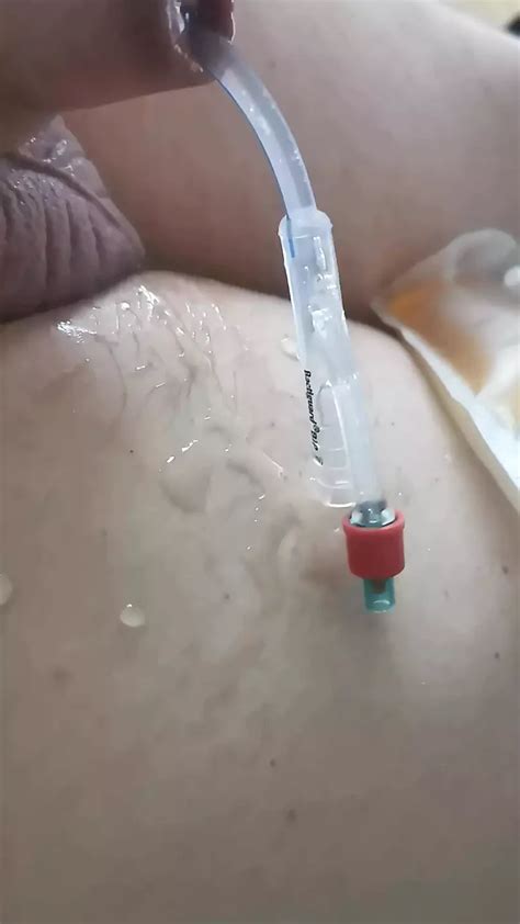 Playing With My Catheter And Cock Gay Amateur Porn Feat