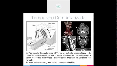 Radioquímica Clase Aplicaciones Médicas de las Radiaciones Ionizantes