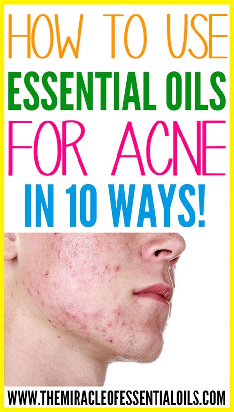 How To Use Essential Oils For Acne Ways The Miracle Of Essential