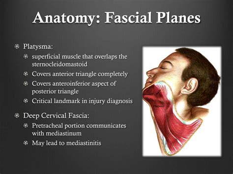 Ppt Airway Management For Neck Trauma Alex Sigalovsky Crna