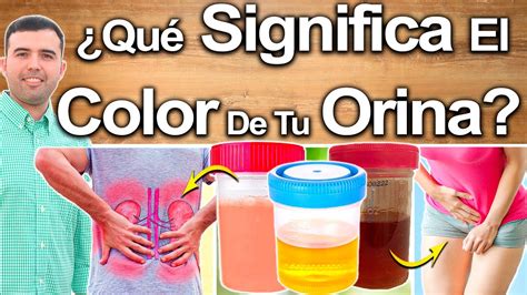 Qu Significa El Color De Tu Orina Enfermedades Que Indica El Color